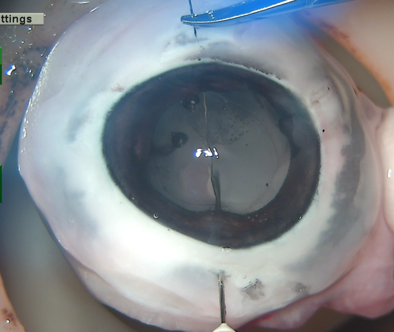 6b93b47c-fc5b-4368-944b-7c39cb3e286b.png 6b93b47c-fc5b-4368-944b-7c39cb3e286b.png